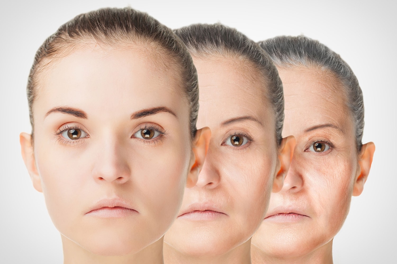 Are You a Good Candidate For Botox®?
