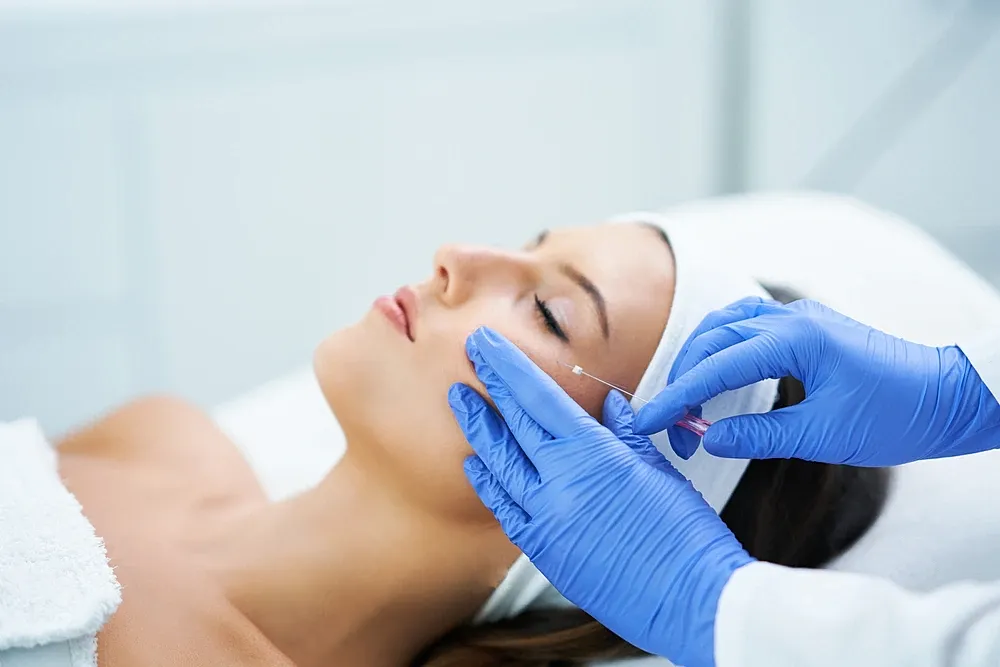 How PDO Threads Can Help Achieve a Defined Jawline
