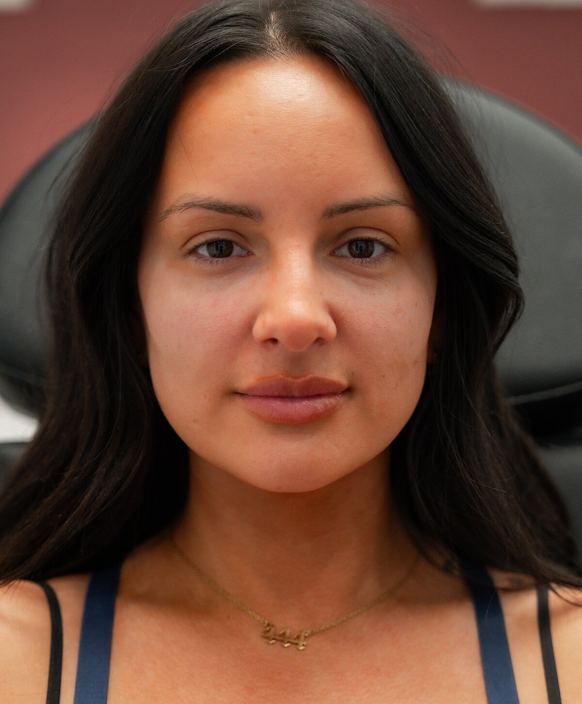 Woman examining lips in mirror at clinic.